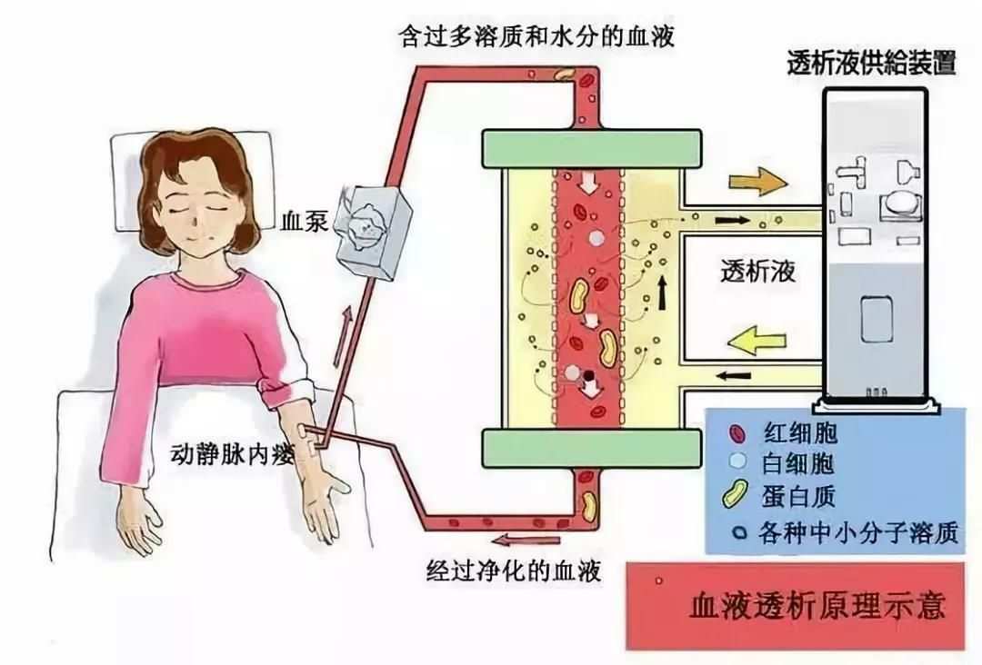 文明透析_文明透析_文明透析